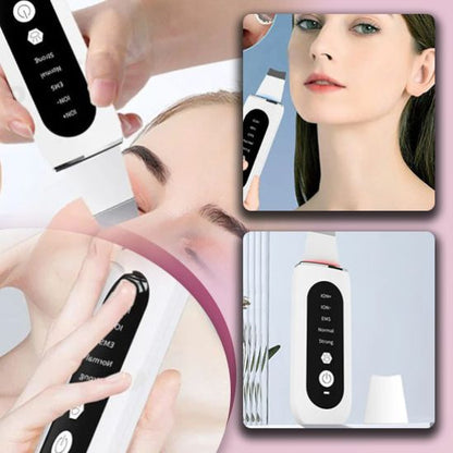 Ultrasonic Skin Scrubber, Ultimate Skin Solution! - NivoLand